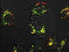 在动物实验中,由于使用了球形核酸,化合物 5-氟尿嘧啶的疗效比普通药物高出 2 万倍。(图片来源:西北大学)