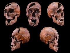 来自布达佩斯玛格丽特岛 13 世纪多明我会修道院的被调查者头骨(图片来源:Eötvös Loránd 大学)