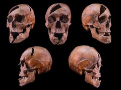 来自布达佩斯玛格丽特岛 13 世纪多明我会修道院的被调查者头骨(图片来源:Eötvös Loránd 大学)