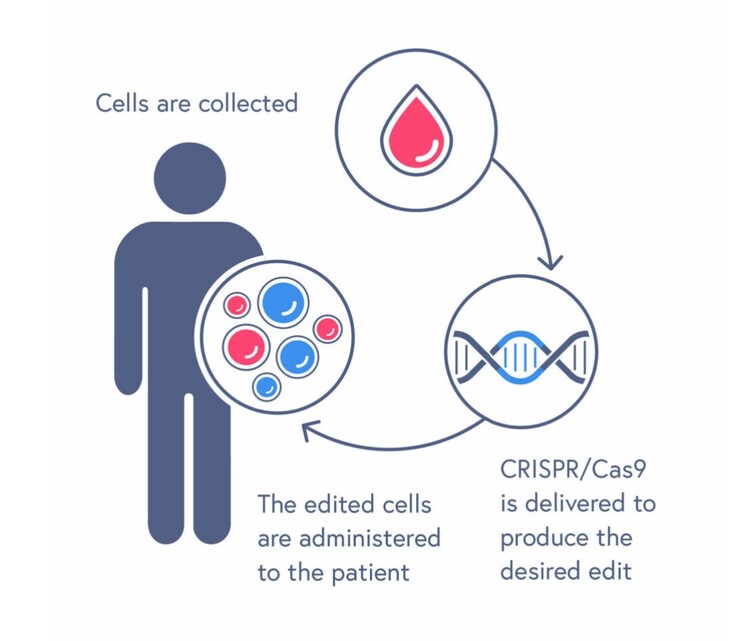 CASGEVY 治疗过程包括输注编辑过的造血干细胞。(来源：CRISPR Therapeutics）