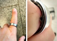 三星Galaxy Ring 电池肿胀，迫使一名用户前往医院就诊。(图片来源：Zone of Tech）