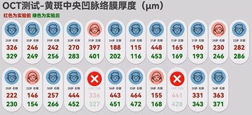 根据Honor 的一项内部研究，通过眼球后部的绒毛膜厚度测量，大多数参与者的暂时性近视都有积极的效果。(图片来源：BiliBili 上的胜利文绉绉)