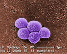 Integrated Biosciences 发现对耐药性 MRSA 细菌有效的新型抗生素。(资料来源：公共卫生图片库 #9994）