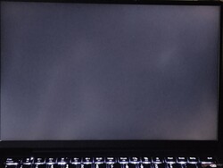 中度背光出血（此处显示已增强）