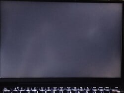 中度背光出血（此处显示已增强）