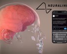 Neuralink 的愿景：通过思考完全控制数字设备（图片来源：Neuralink）