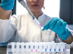 牛津生物治疗公司和罗氏公司宣布建立癌症治疗战略合作伙伴关系（图片来源：Julia Koblitz, Unsplash）