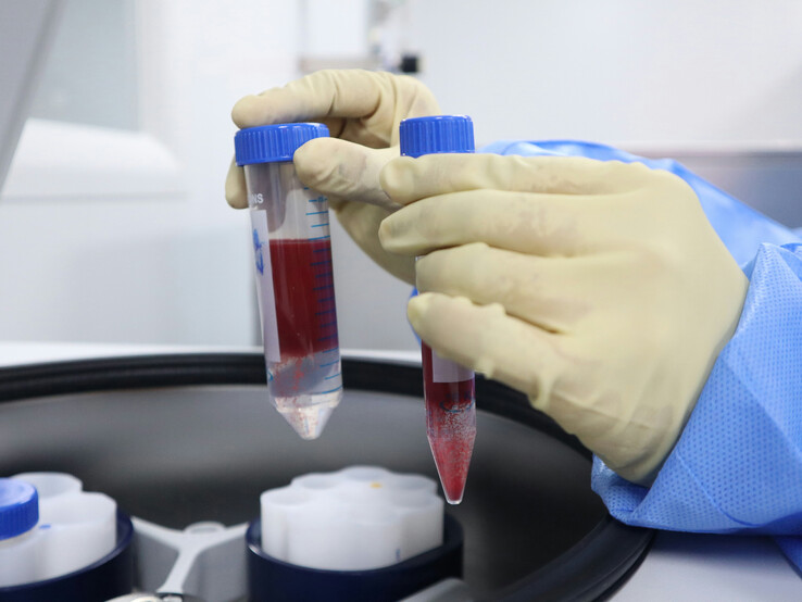 血液检测实验室是因 Synnovis 供应链网络攻击而中断的 NHS 服务之一（图片来源：Unsplash/Malcolm Choong）。