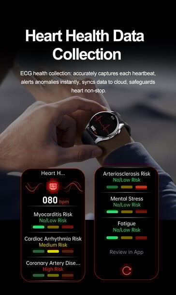 (图片来源：Rogbid）