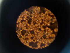 显微镜下的血细胞（图片来源：ThisisEngineering via Unsplash；已裁剪）