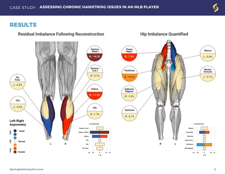 Springbok Analytics 的报告通过三维核磁共振成像扫描详细描述了个体肌肉。(来源：Springbok Analytics）