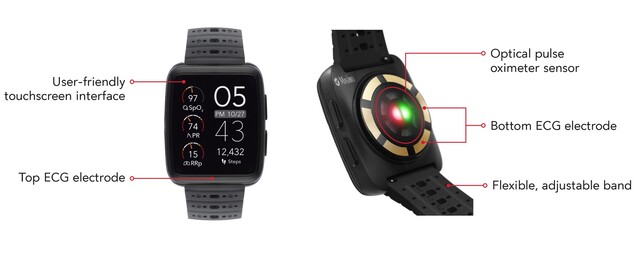 Masimo W1 手表设计用于持续监测 SpO2 和其他生命体征。(来源：Masimo）